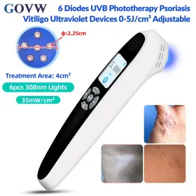 Pd02w35 Govw Handheld 308nm Uvb Light Therapy Lamp For Face Hand Foot Skin Disorders At Home