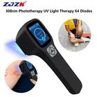 308NM Uv Light Therapy Device For Skin Diseases Treatment Home Care Rechargeable New. Price: $1199.45.
