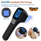 Dawfek 308NM Uvb Light Therapy Lamp Handheld Led Device 64 Diodes 0-50MW/CM2 New. Price: $1199.00.