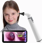 Wireless Otoscope Ear Camera With Dual View, 3.9MM 720PHD Wifi 6 Led New. Price: $33.99.
