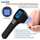 Dawfek 308NM Handheld Uvb Therapy Lamp Device 64 Leds Portable New. Price: $1199.04.