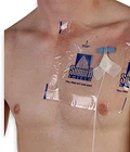 9" X SS99 Picc Line Cover Moisture Barrier - 2 Week Supply (pack Of 14) Wat New. Price: $31.23.