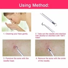 Remover Spoon Picker And Pimple Blackhead Tools - Combo New. Price: $21.86.