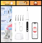 Smart Visual Dental Scaler With Hd Camera, Led Light, Wireless Oral Care Tool, 5 New. Price: $111.59.