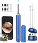 Bebird X17 Camera Endoscope Professional Visual Ear Cleaner Wax Removal New. Price: $18.99.