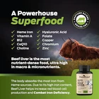 Forestleaf Grass Fed Beef Liver Capsules, 3000MG Per Serving, Supports Immunity New. Price: $58.42.