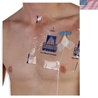 9" X SS99 Picc Line Cover Moisture Barrier - 2 Week Supply Pack Of 14 Wa... New. Price: $50.92.