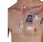 9" X SS99 Picc Line Cover Moisture Barrier - 2 Week Supply (pack Of 14) ... New. Price: $31.15.