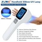 Zjkc 308NM Uvb Lamps Light Phototherapy Device For Skin Diseases New. Price: $791.28.