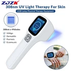 Zjzk Home Phototherapy Uvb Light Lamp Device For Skin Diseases Treatment 308NM New. Price: $1099.20.